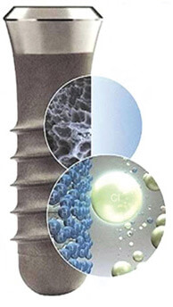 implant bursa